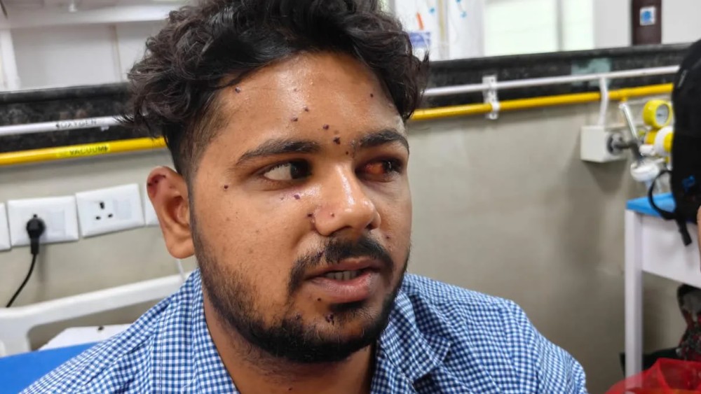 Delhi pellet gun crackdown revives painful memories of Indian-occupied Kashmir